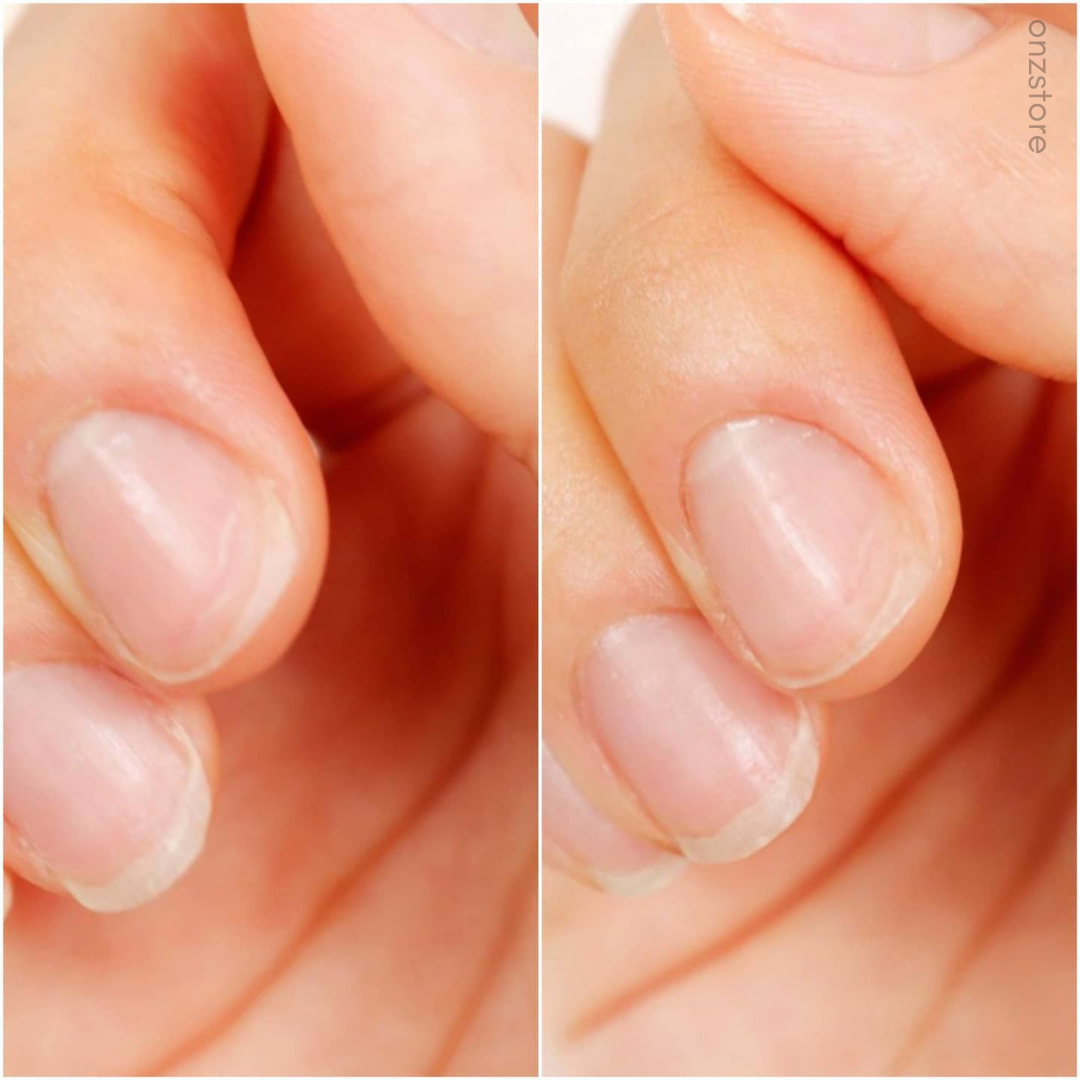 ★Cosnori★ Silk Repair Nail Cream