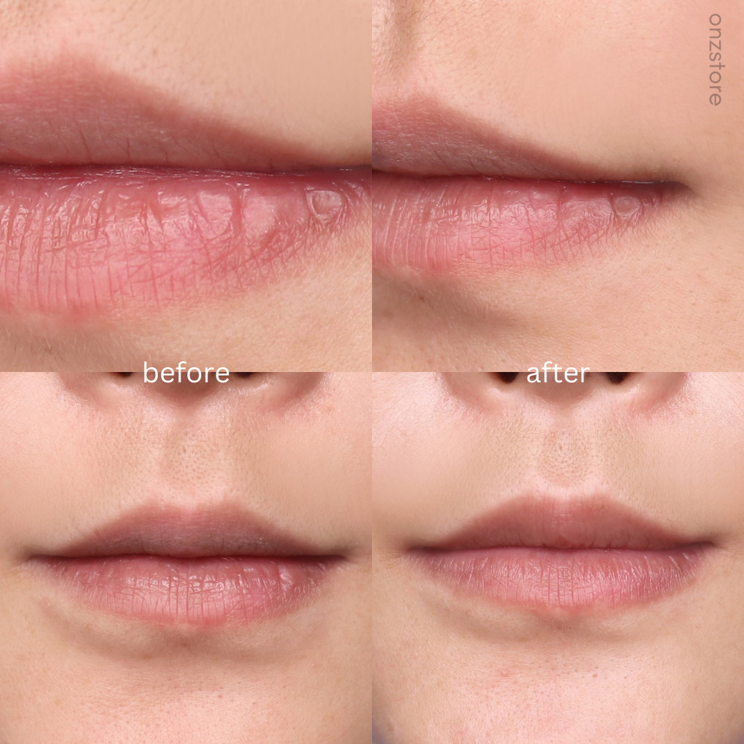 ★Sidmool★ Lip Essence