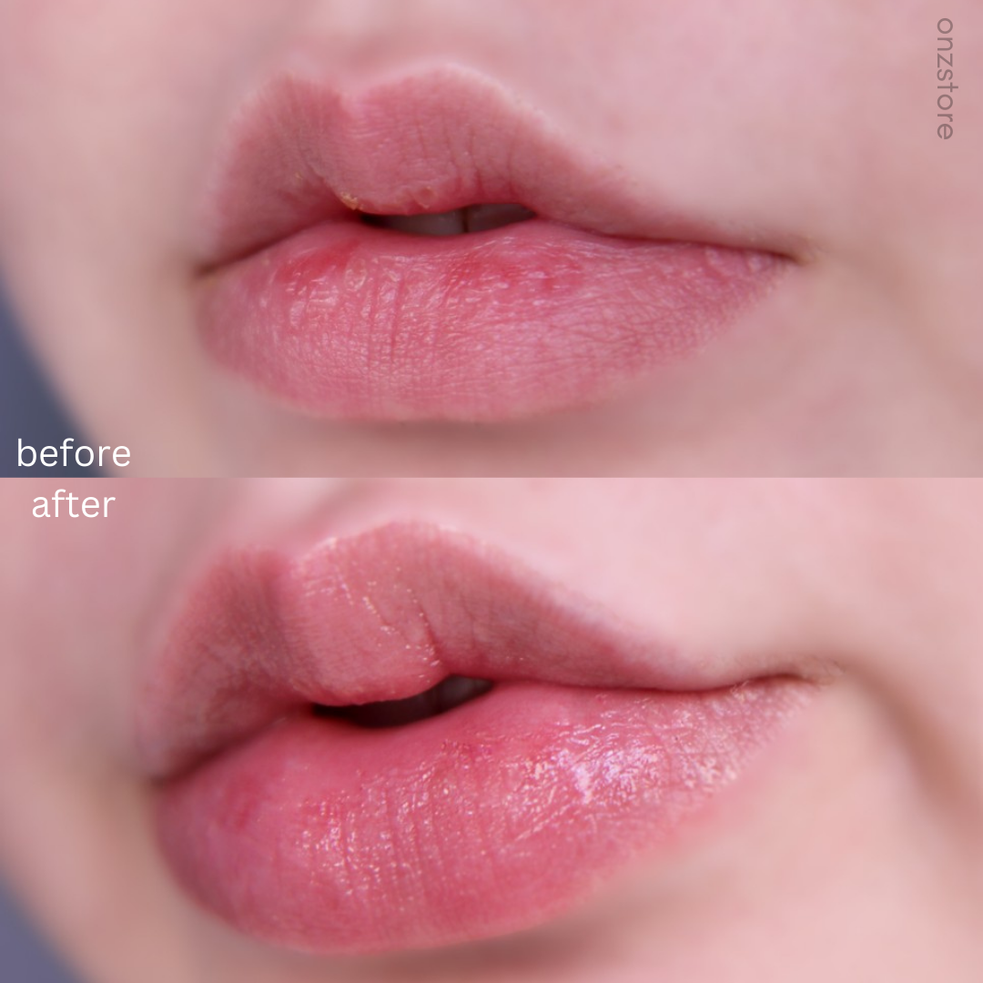★Sidmool★ Lip Essence