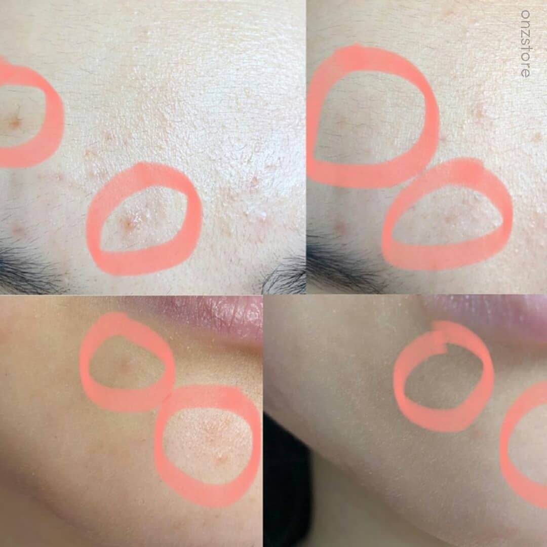 ★Milktouch★ Five Flower Dark Spot Clearing Serum