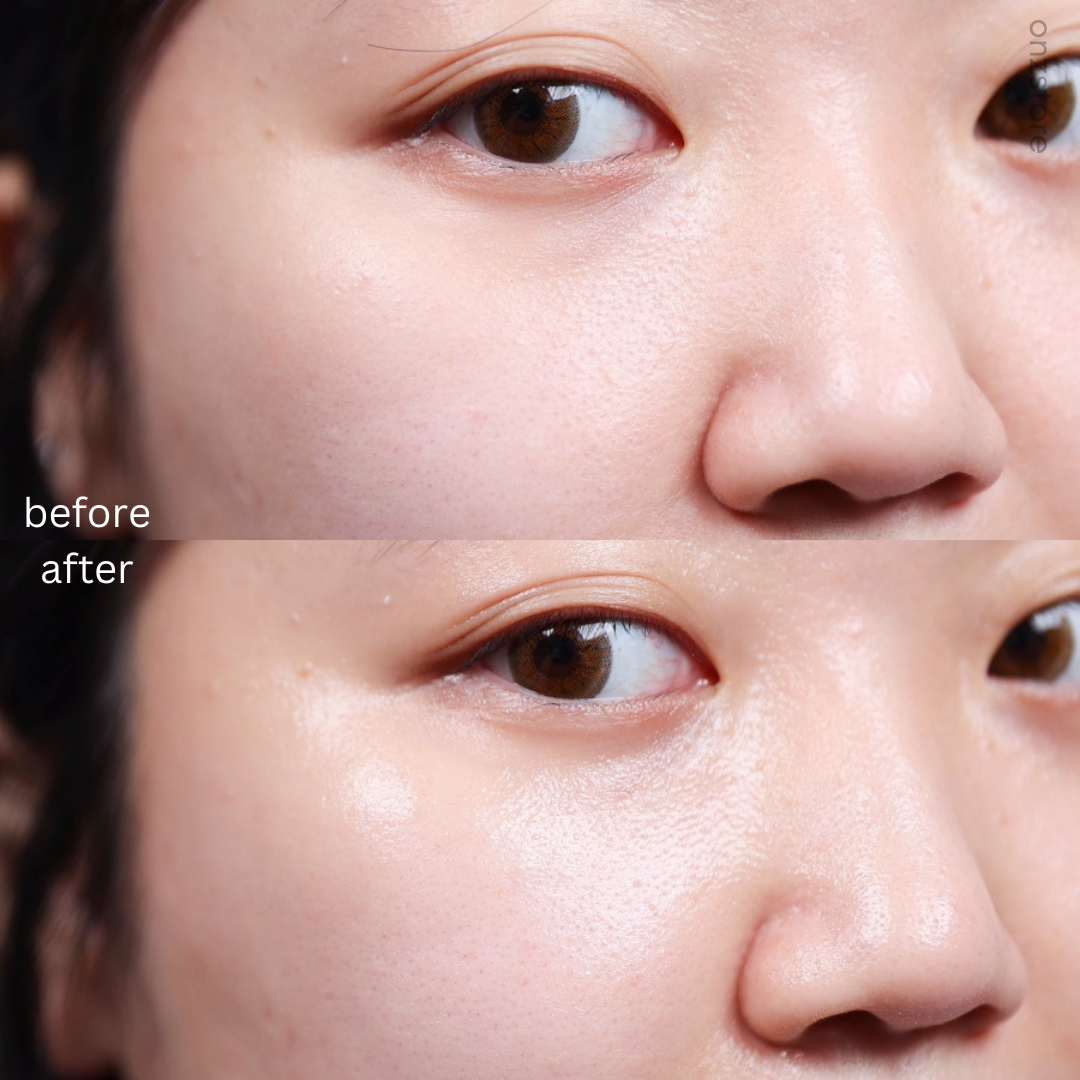 ★Dr.g★ RED Blemish Clear Soothing Cream (For Dry Skin)