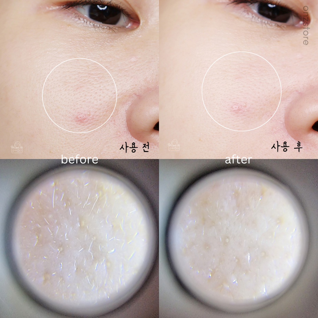 ★Hanyul★ Chestnut Pore Mask Pack