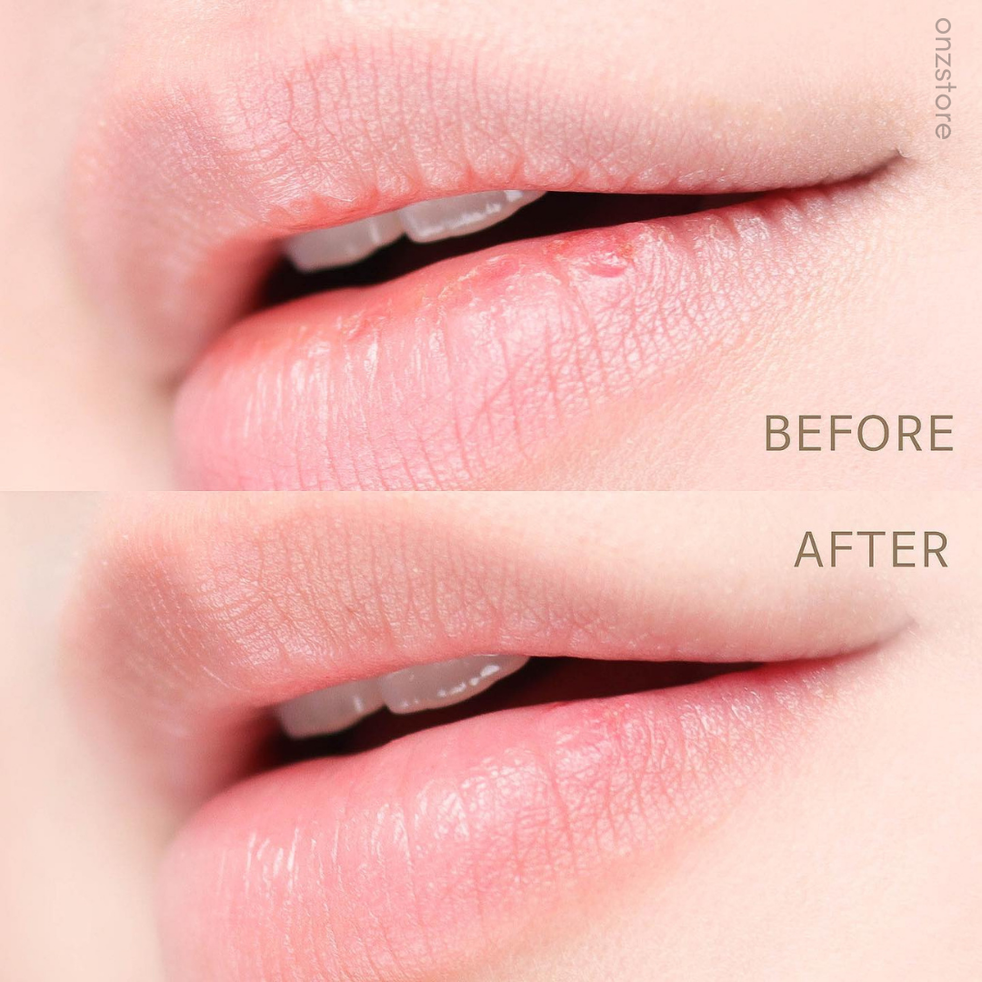 ★Liplief★ Steaming Lip Mask