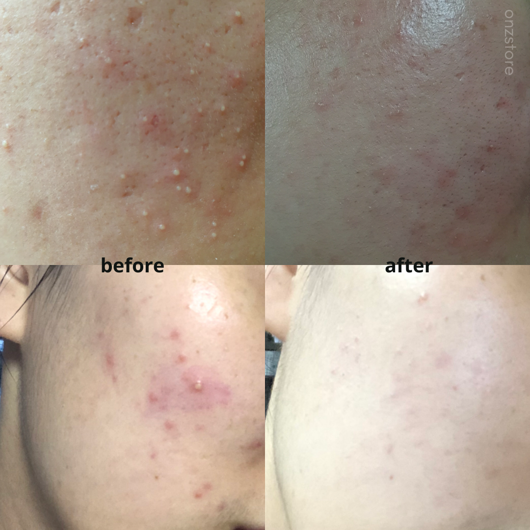 ★Alive Lab★ Centella Dressing Powder