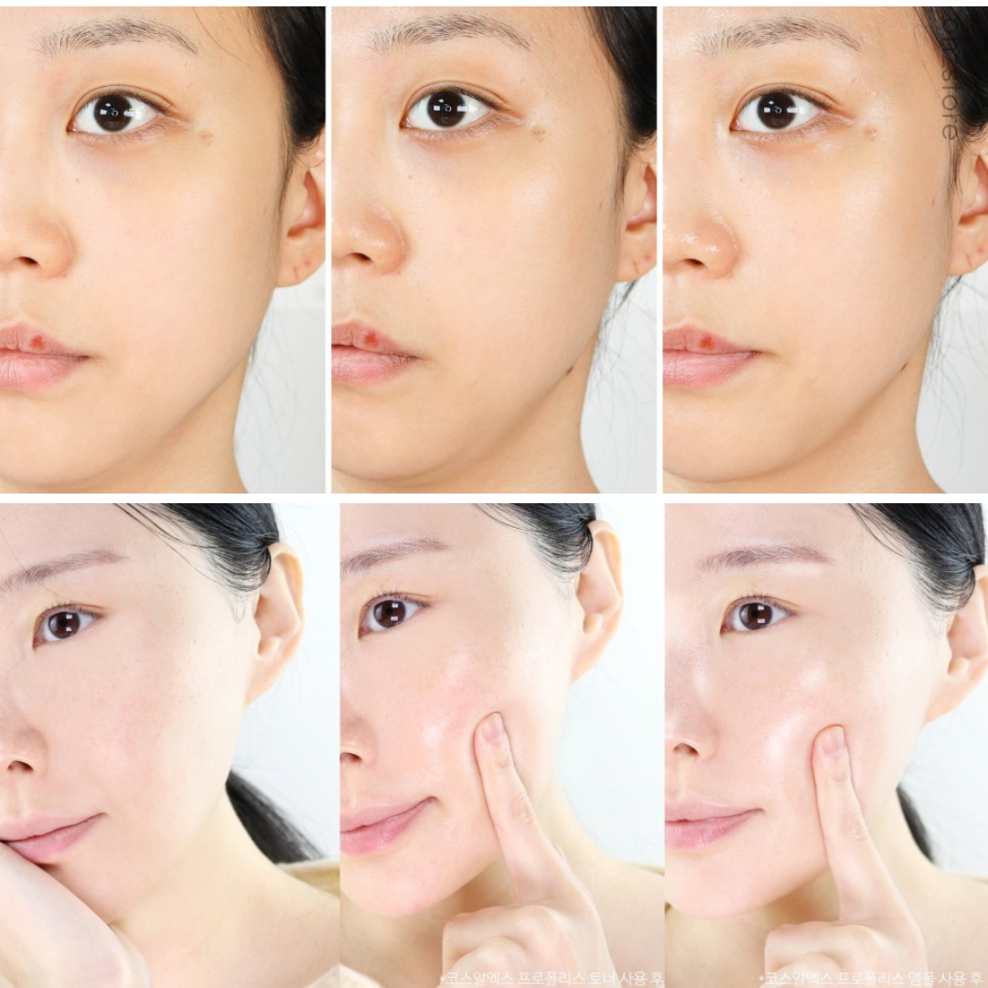 ★Cosrx★ Propolis Light Ampoule