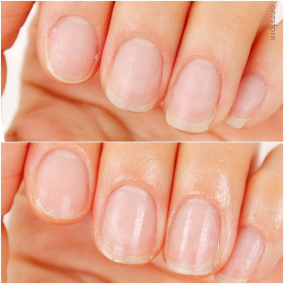 ★Cosnori★ Silk Repair Nail Cream