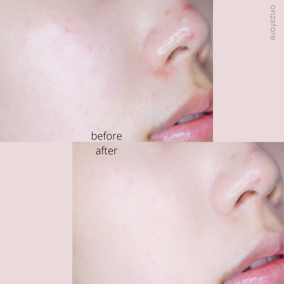 ★Javin De Seoul★ Wink Foundation Pact