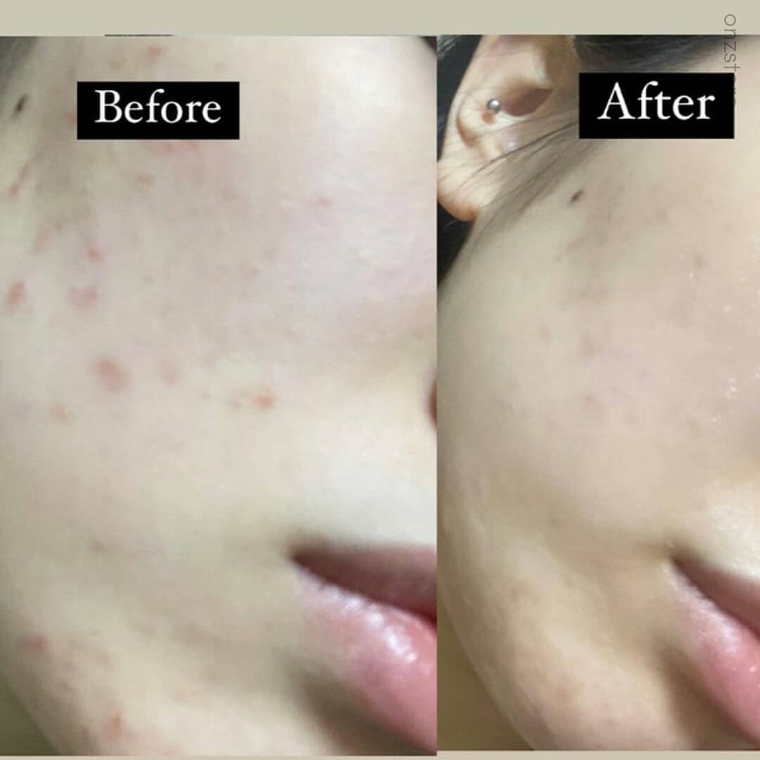 ★Milktouch★ Five Flower Dark Spot Clearing Serum