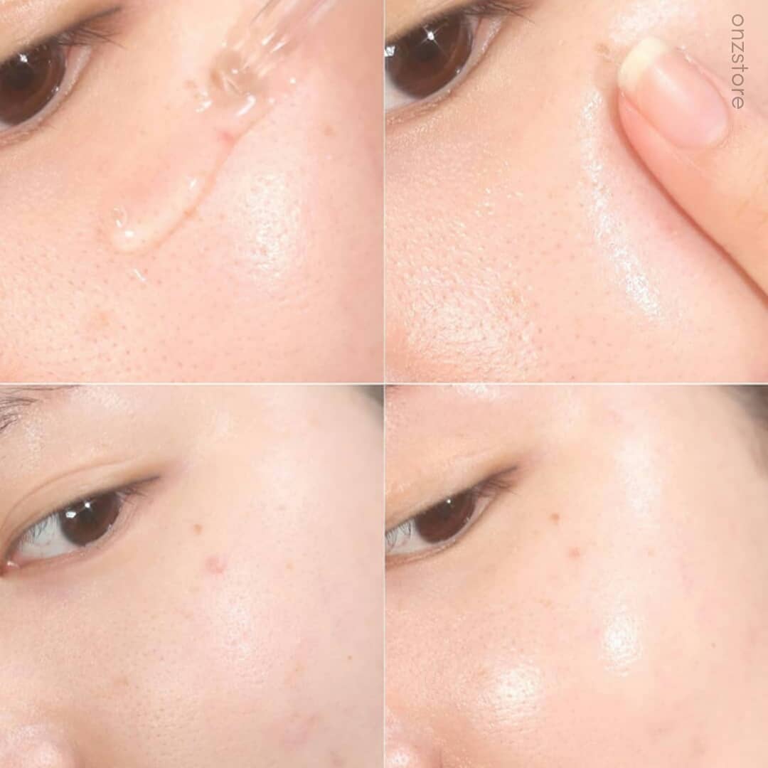 ★Milktouch★ Five Flower Dark Spot Clearing Serum