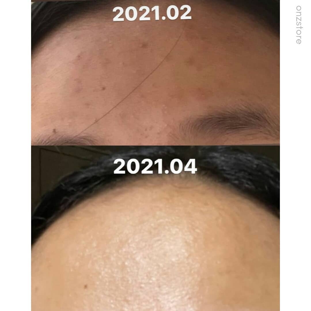 ★Milktouch★ Five Flower Dark Spot Clearing Serum