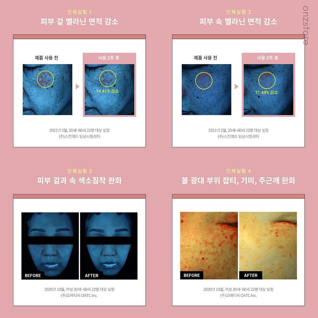 ★Milktouch★ Five Flower Dark Spot Clearing Serum