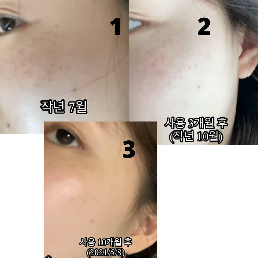 ★Milktouch★ Five Flower Dark Spot Clearing Serum