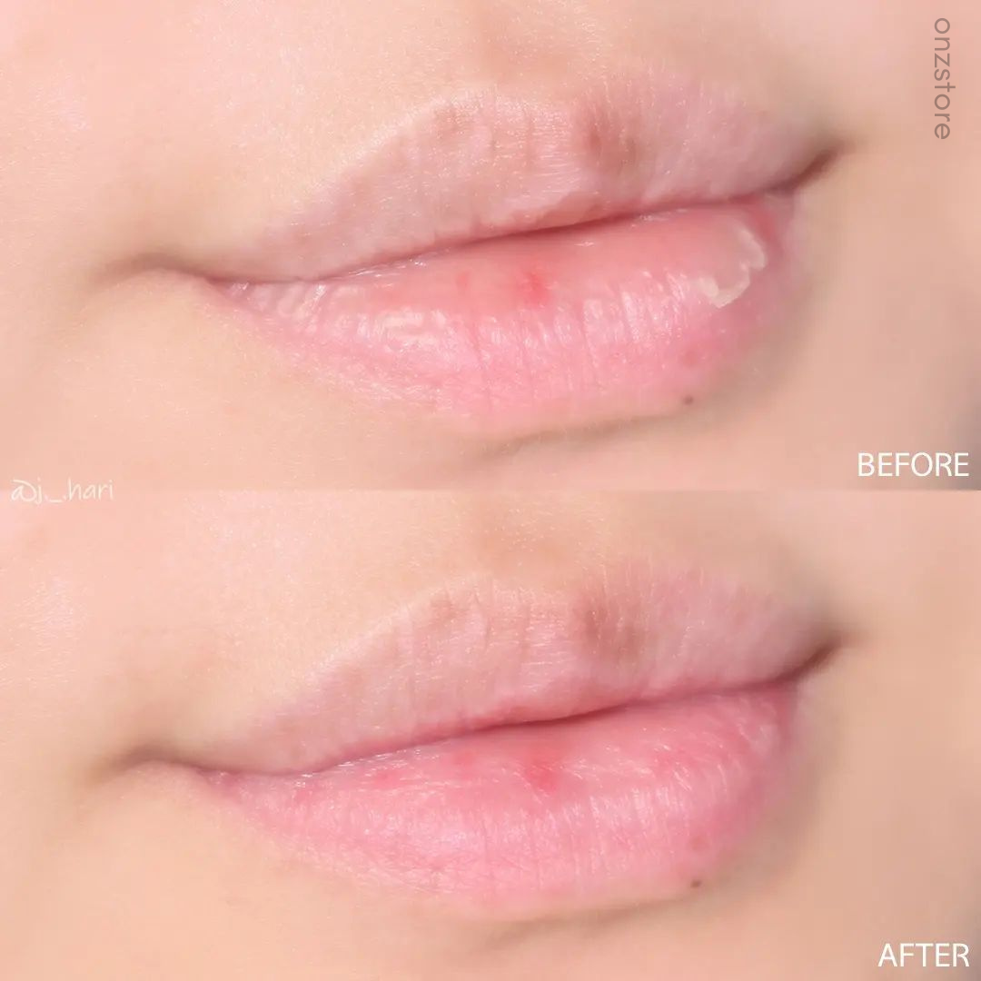 ★Liplief★ Steaming Lip Mask