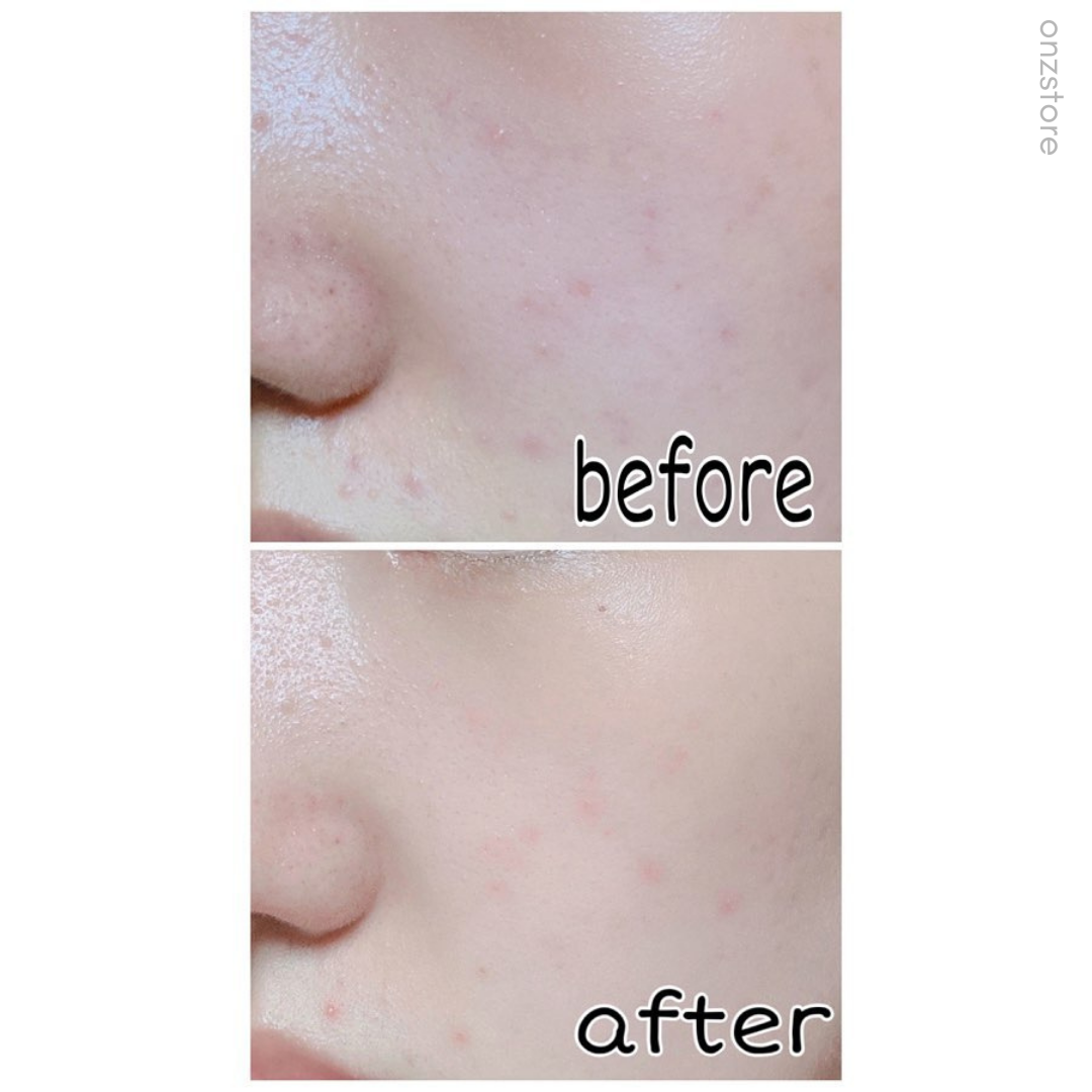 ★Roundlab★ Birch Juice Moisturizing Cream