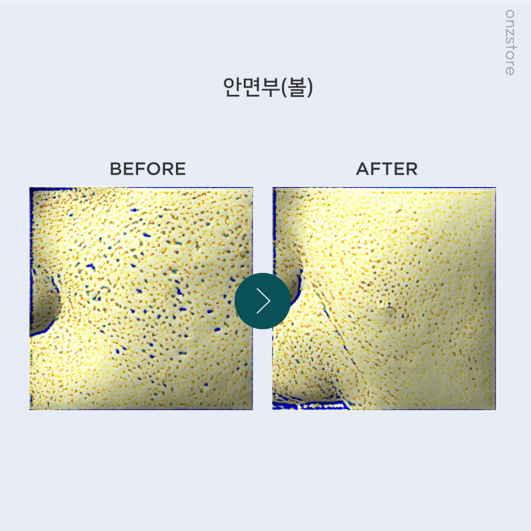 ★Aromatica★ Tea Tree Pore Purifying Gel Cream