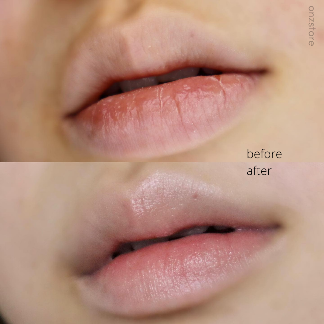 ★Liplief★ Steaming Lip Mask